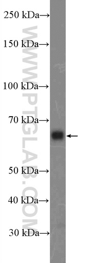 [26055-1-AP-20UL] ITPRIP Polyclonal antibody
