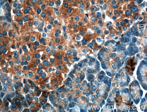 [26062-1-AP-150UL] UBXN10 Polyclonal antibody