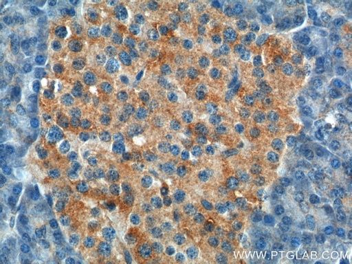 [26069-1-AP-20UL] UBR1 Polyclonal antibody