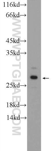 [26070-1-AP-150UL] AGPHD1 Polyclonal antibody