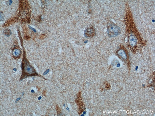 [26074-1-AP-150UL] C1orf9 Polyclonal antibody