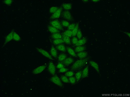 [26081-1-AP-150UL] ZC3H11A Polyclonal antibody