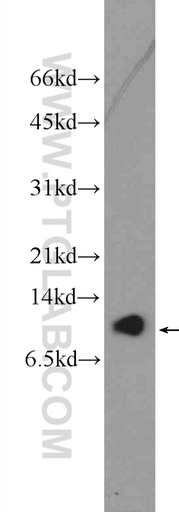[26086-1-AP-20UL] C16orf61 Polyclonal antibody