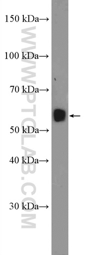 [26094-1-AP-20UL] C15orf27 Polyclonal antibody