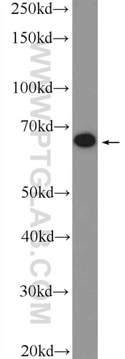 [26098-1-AP-20UL] MBTD1 Polyclonal antibody