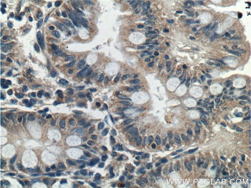 [26099-1-AP-20UL] C12orf69 Polyclonal antibody