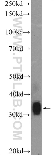 [26103-1-AP-150UL] FLJ25006 Polyclonal antibody