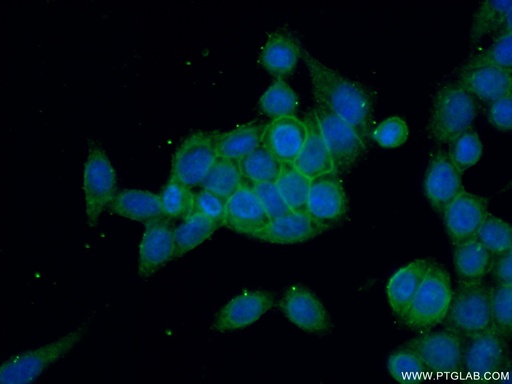 [26105-1-AP-20UL] RDX Polyclonal antibody