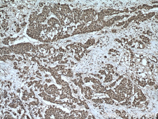 [26112-1-AP-150UL] TTC5 Polyclonal antibody