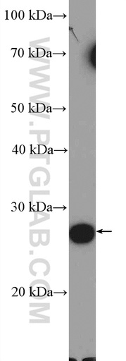 [26113-1-AP-150UL] C19orf20 Polyclonal antibody