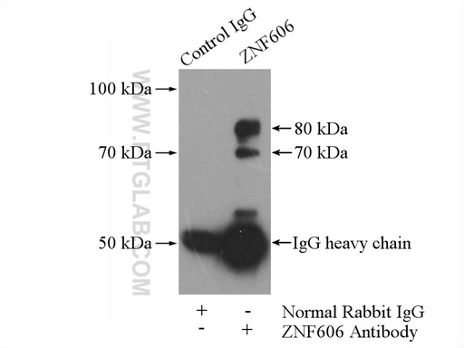 [26128-1-AP-20UL] ZNF606 Polyclonal antibody