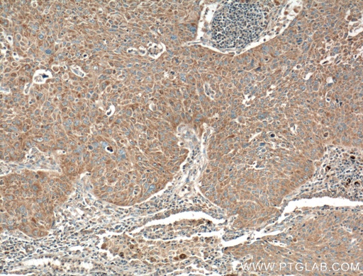 [26132-1-AP-150UL] RGS11 Polyclonal antibody