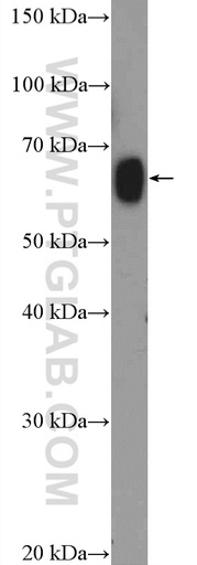 [26134-1-AP-20UL] ZNF470 Polyclonal antibody