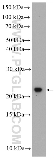[26138-1-AP-20UL] C1orf86 Polyclonal antibody