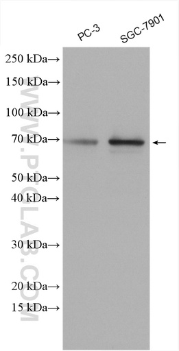[26143-1-AP-150UL] DUB3 Polyclonal antibody