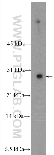 [26151-1-AP-20UL] MYEOV2 Polyclonal antibody