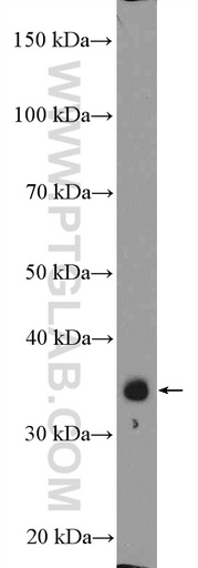 [26152-1-AP-20UL] ZC3H8 Polyclonal antibody