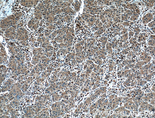 [26156-1-AP-20UL] IL-2 Polyclonal antibody
