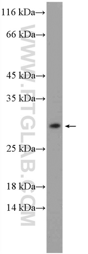 [26168-1-AP-20UL] MOSPD3 Polyclonal antibody