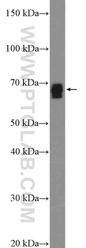 [26182-1-AP-150UL] SLC13A3 Polyclonal antibody