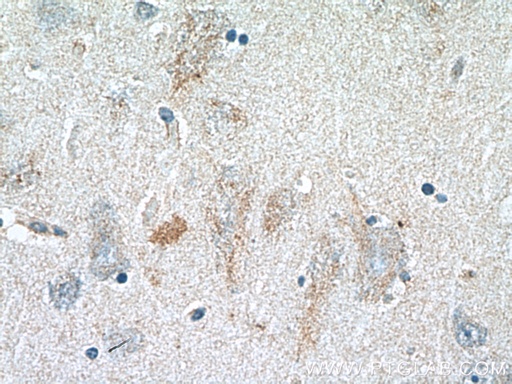 [26185-1-AP-20UL] GLDN Polyclonal antibody