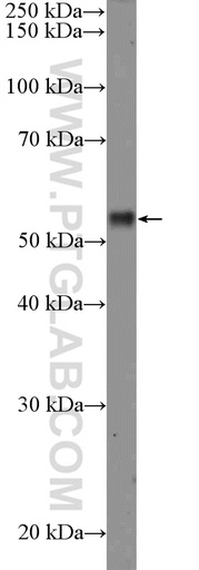 [26194-1-AP-150UL] RPS6KB2 Polyclonal antibody