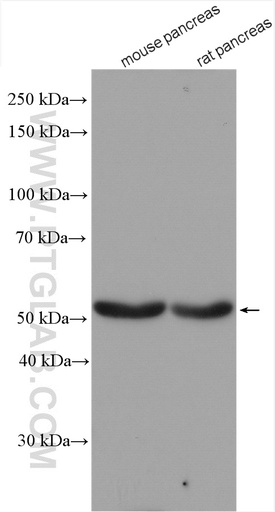 [26196-1-AP-20UL] GLP1R Polyclonal antibody
