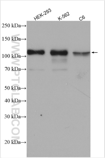 [26200-1-AP-150UL] GAB1 Polyclonal antibody