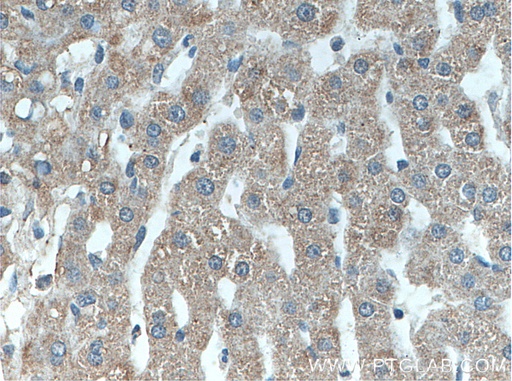[26205-1-AP-150UL] Piezo2 Polyclonal antibody