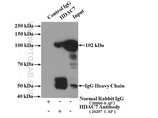 [26207-1-AP-150UL] HDAC7 Polyclonal antibody