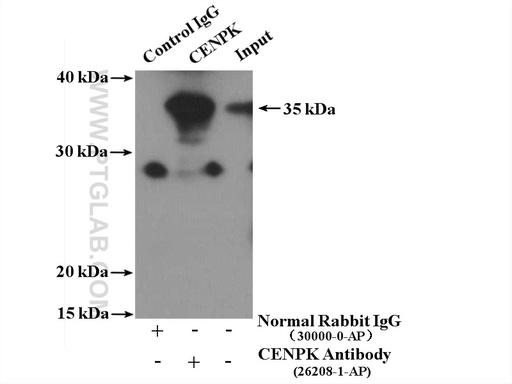 [26208-1-AP-20UL] CENPK Polyclonal antibody