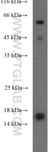 [26209-1-AP-20UL] POLD4 Polyclonal antibody