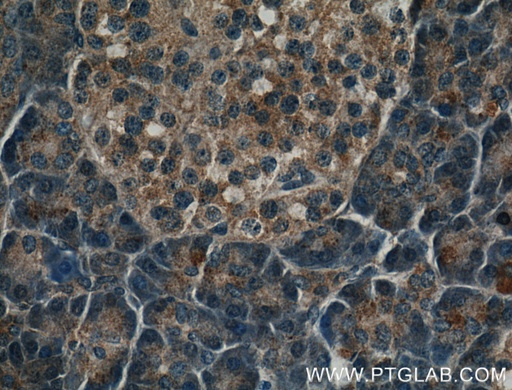 [26218-1-AP-20UL] PNLIPRP2 Polyclonal antibody
