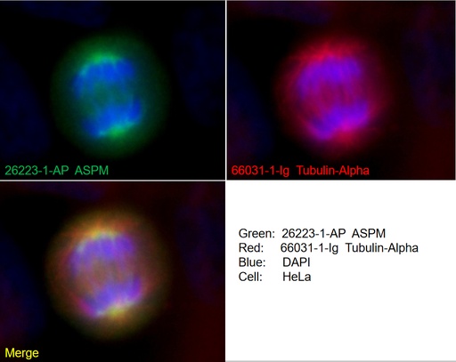 [26223-1-AP-150UL] ASPM Polyclonal antibody