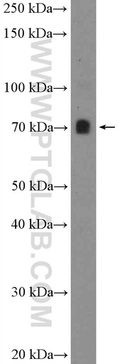 [26225-1-AP-150UL] PATZ1 Polyclonal antibody