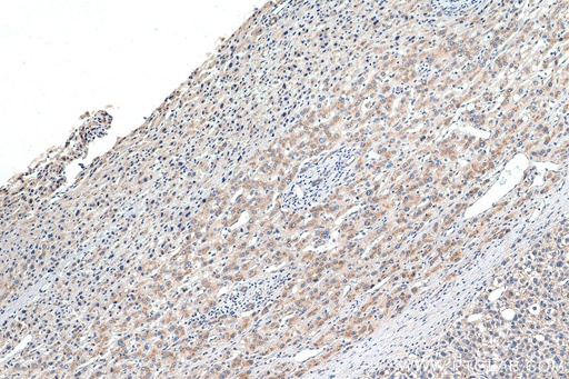 [26226-1-AP-150UL] EDEM1 Polyclonal antibody