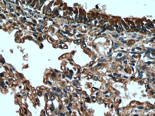 [26228-1-AP-20UL] SCGB3A2 Polyclonal antibody