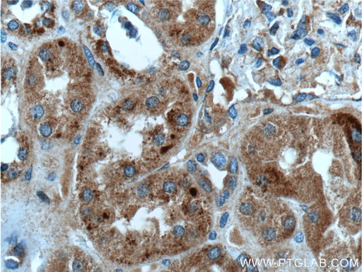 [26233-1-AP-20UL] FAHD1 Polyclonal antibody