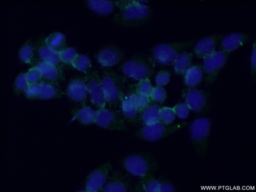 [26234-1-AP-20UL] PPAPDC2 Polyclonal antibody