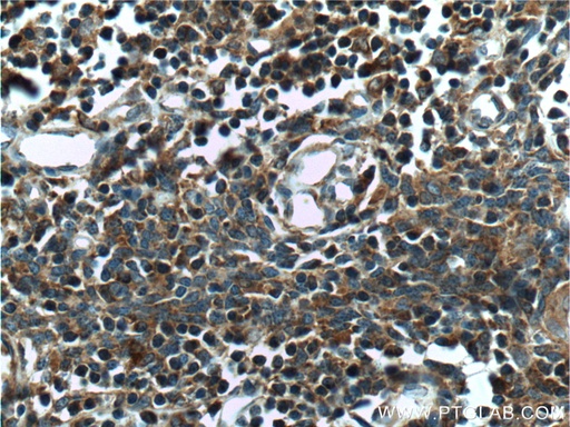 [26240-1-AP-20UL] COMMD3 Polyclonal antibody