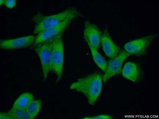 [26241-1-AP-20UL] ZC3H15 Polyclonal antibody