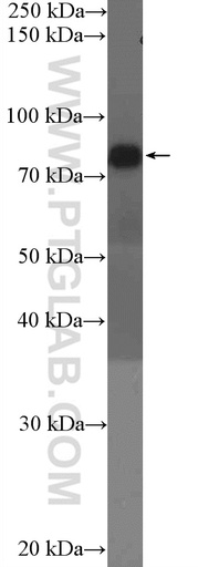 [26247-1-AP-20UL] GIT1 Polyclonal antibody