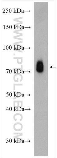[26252-1-AP-20UL] HRG Polyclonal antibody