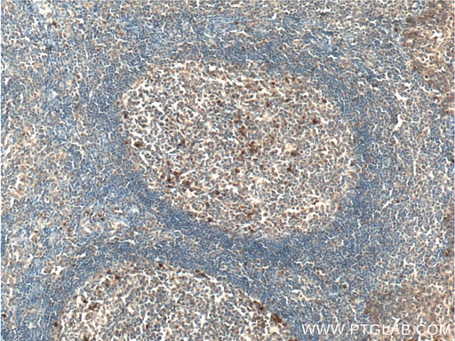 [26257-1-AP-20UL] CLEC16A Polyclonal antibody