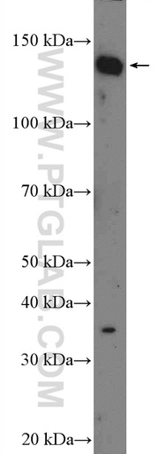 [26264-1-AP-150UL] C14orf106 Polyclonal antibody