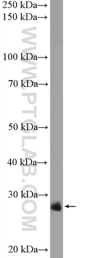 [26265-1-AP-150UL] C1orf216 Polyclonal antibody