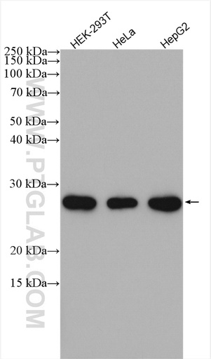 [26268-1-AP-150UL] SPC24 Polyclonal antibody