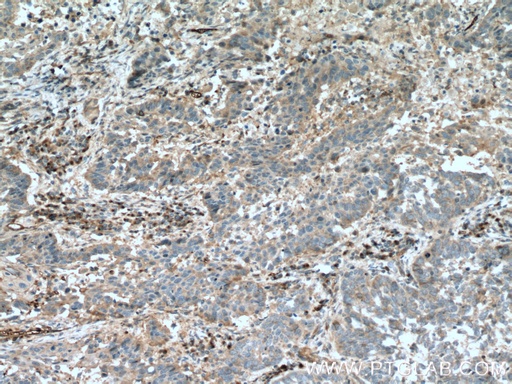 [26272-1-AP-150UL] FGF21 Polyclonal antibody
