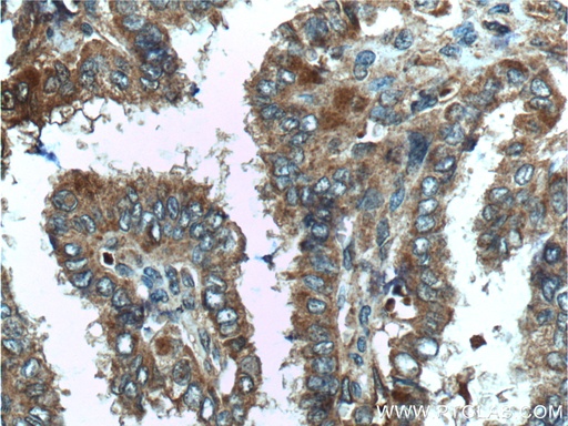 [26279-1-AP-20UL] C8orf4 Polyclonal antibody