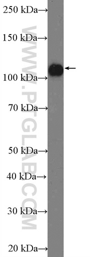 [26293-1-AP-150UL] ANKLE2 Polyclonal antibody